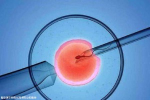 代妈应聘公司